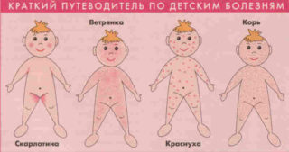 Сыпь у ребенка на животе и попе без температуры