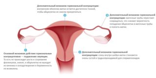 Почему при менструации не болит живот