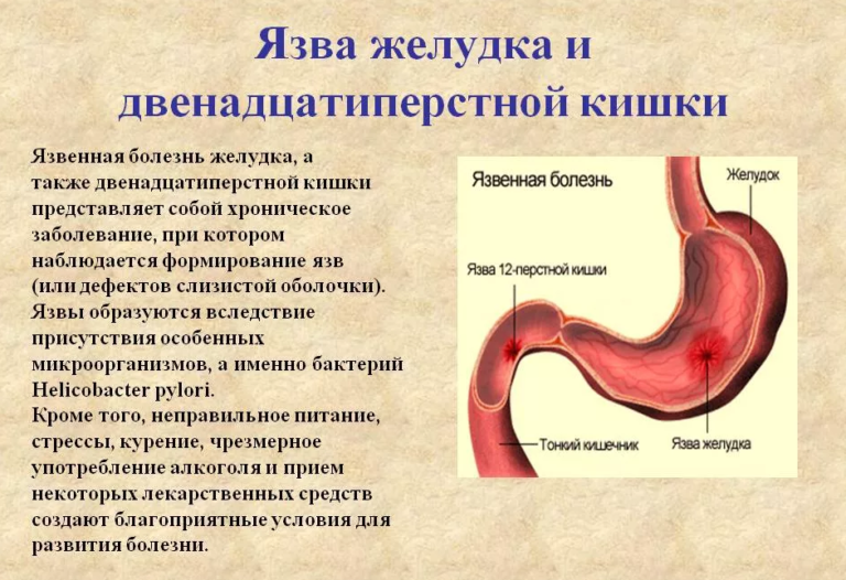 Боли в животе фото где что находится