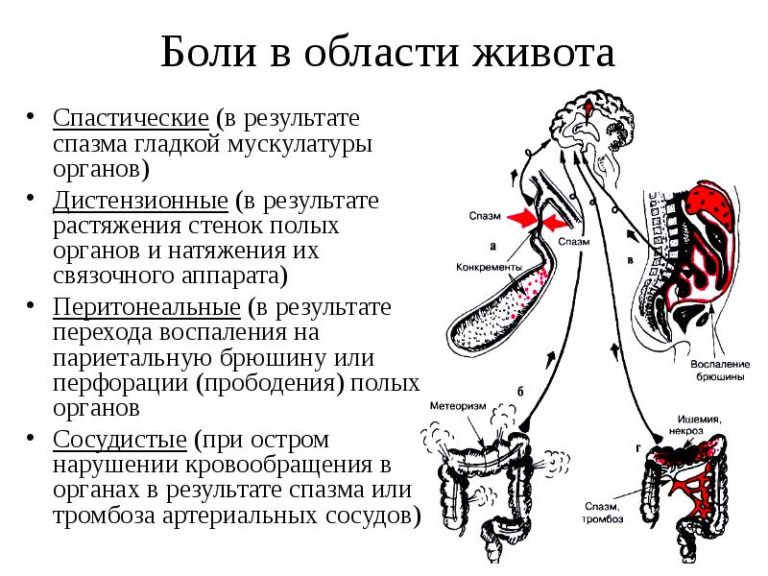 Боли в животе фото где что находится