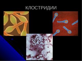 Внешний вид бактерий клостридий