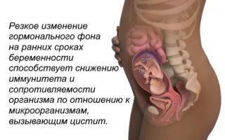 9 недель беременности болит живот как при месячных thumbnail