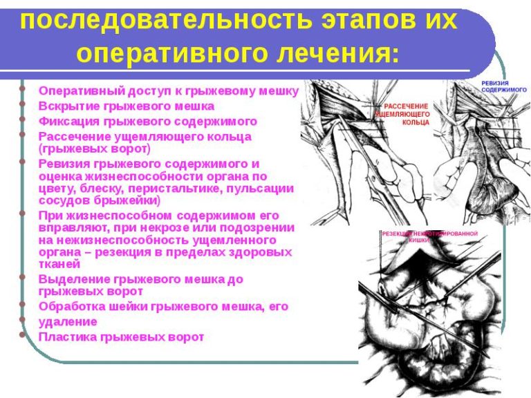 Руководство по кинезитерапии лечение боли в спине и грыж позвоночника бубновский с м