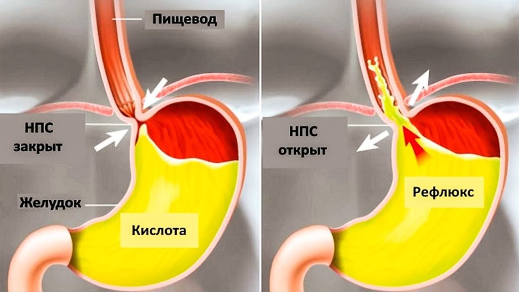 Что находится в левом боку у человека ниже ребер у мужчин спереди фото и название