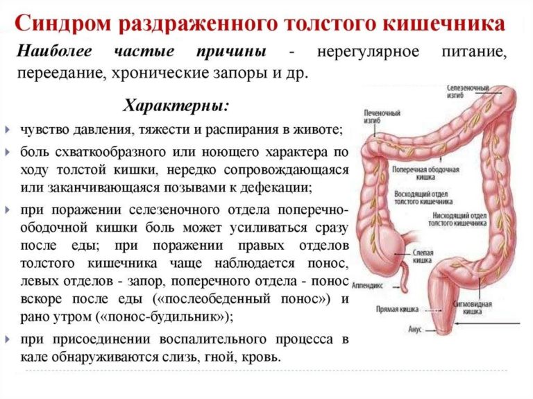 Карандашный стул при синдроме раздраженного кишечника