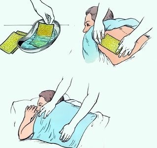 Как поставить горчичники на грудь при кашле