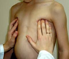 Болит грудь при растяжении мышц