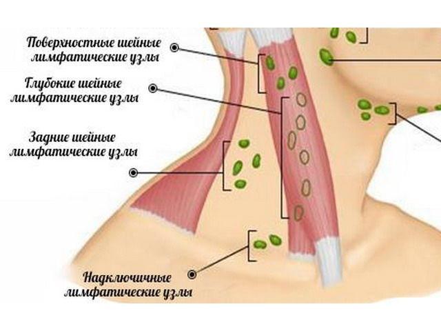 Лимфоузлы на ключице расположение схема расположения