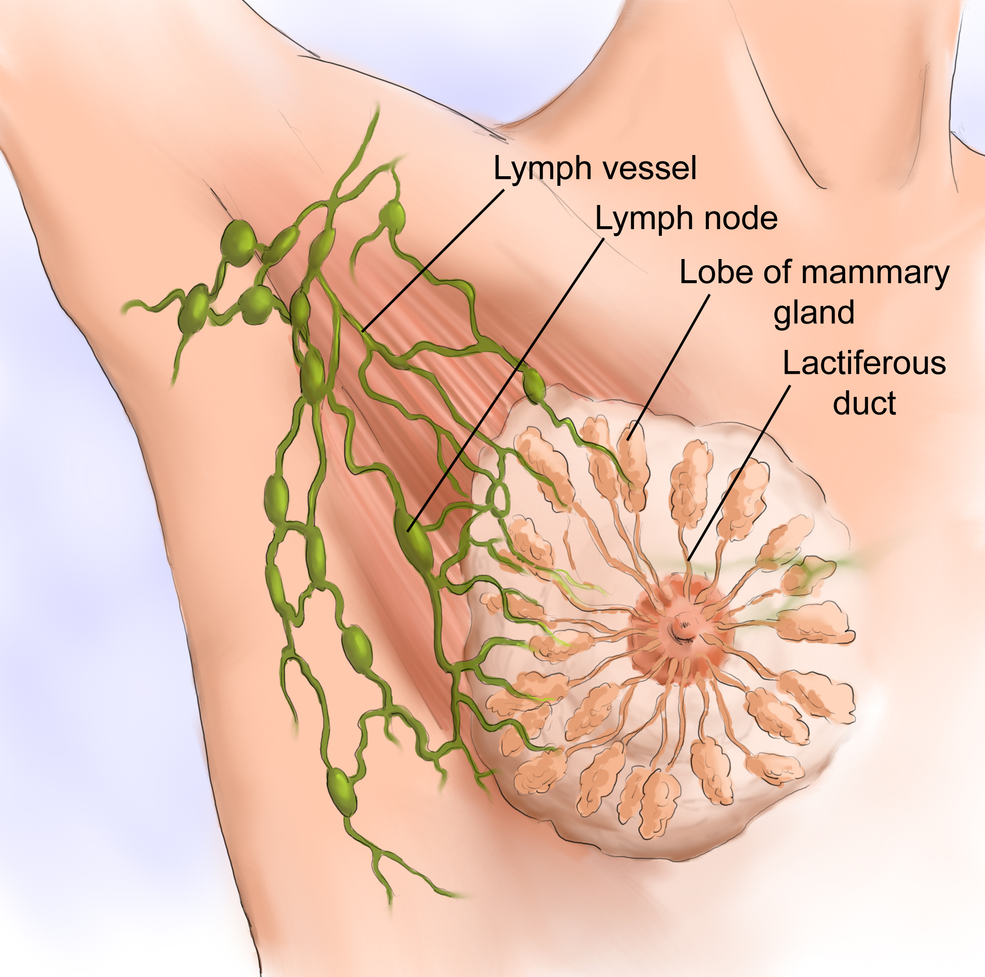 Лимфы подмышек. Воспаление лимфатические узлы грудные железы. Строение молочной железы лимфоузлы. Подмышечные лимфатические узлы. Лимфатические узлы под мышкой.
