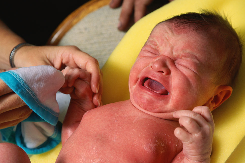 Почему набухли молочные железы у новорожденной девочки?
