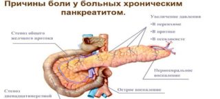 Болит грудная мышца слева у женщин thumbnail