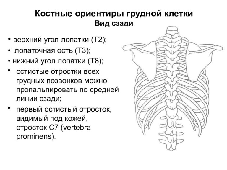 Формы грудины женские картинки