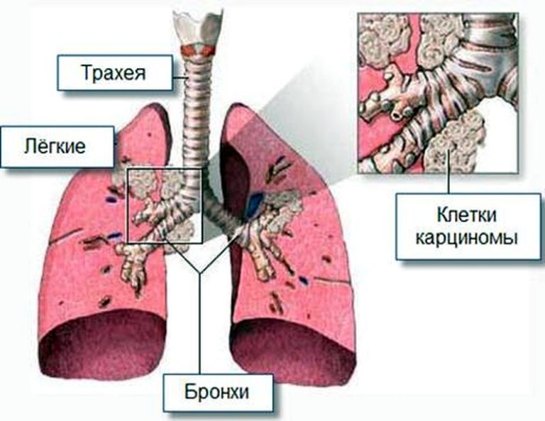 После стула жжение и зуд