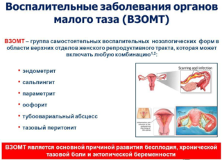 Острая боль в пояснице при менструации