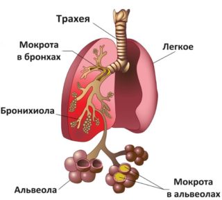 Заложенность в грудной клетке сухой кашель