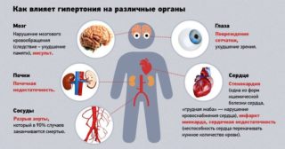 Мкб 10 синдром позвоночной артерии лечение