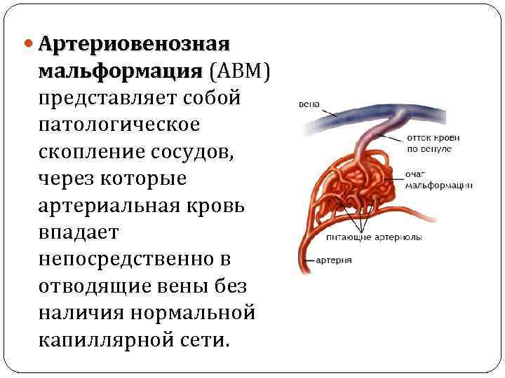 Сосудистая аномалия. АВМ классификация венозные мальформации. Артериовенозные мальформации сосудов головного мозга. Артериально венозная мальформация сосудов. Симптомы артериовенозной мальформации.
