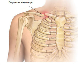 Боль в груди справа - причины, диагностика и лечение