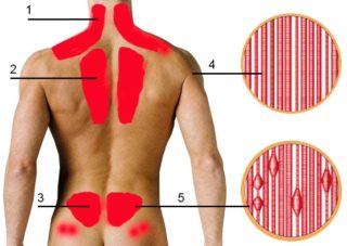 Болит спина в области лопаток и грудная клетка и кашель
