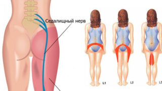 Болит спина в области поясницы слева отдает в ногу и пах