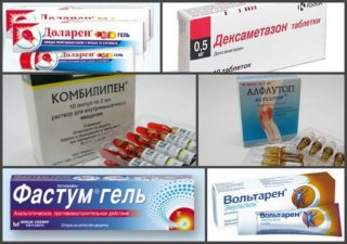 Обезболивающие препараты (таблетки, мази) при болях в спине и пояснице