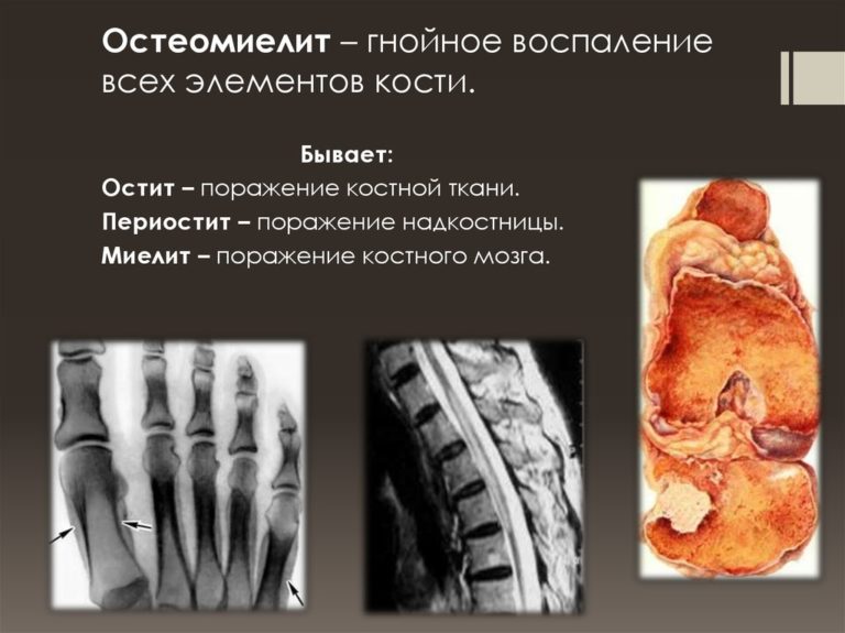 Лопух на колено какой стороной класть к больному месту фото