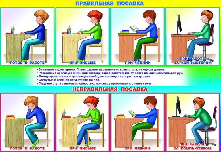 Сколиоз фото детей школьного возраста