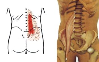 Болит трапециевидная мышца спины слева