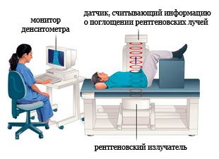 Рентгеновская остеоденситометрия поясничного отдела