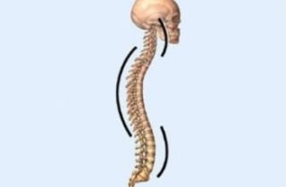 Позвоночник изгибы физиологические и патологические
