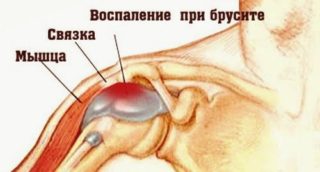 Боль под правой лопаткой сзади со спины причины отдает в правую руку