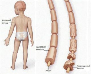Массаж мышц спины ребенку