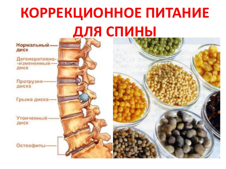 Болит спина витамины. Продукты полезные для межпозвоночных дисков. Питание для позвоночника. Продукты полезные для позвоночника. Остеохондроз.