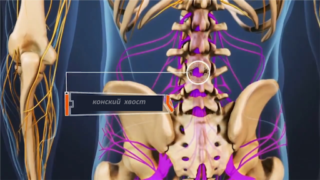 Почему болит спина после спинальной анестезии