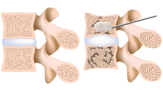 Растяжка спины грудного отдела позвоночника