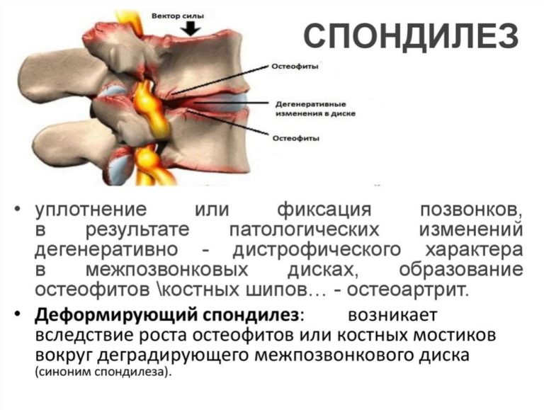 Карта вызова смп перелом позвоночника