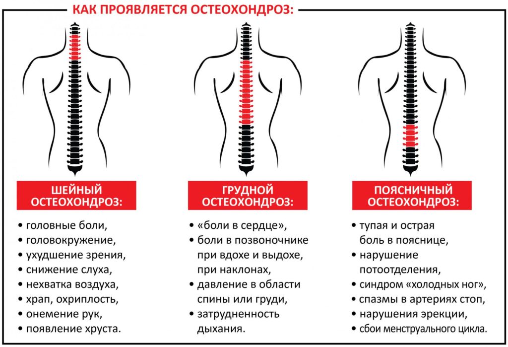 Жировик на позвоночнике фото