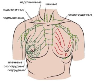 Размер надключичных и подключичных лимфоузлов