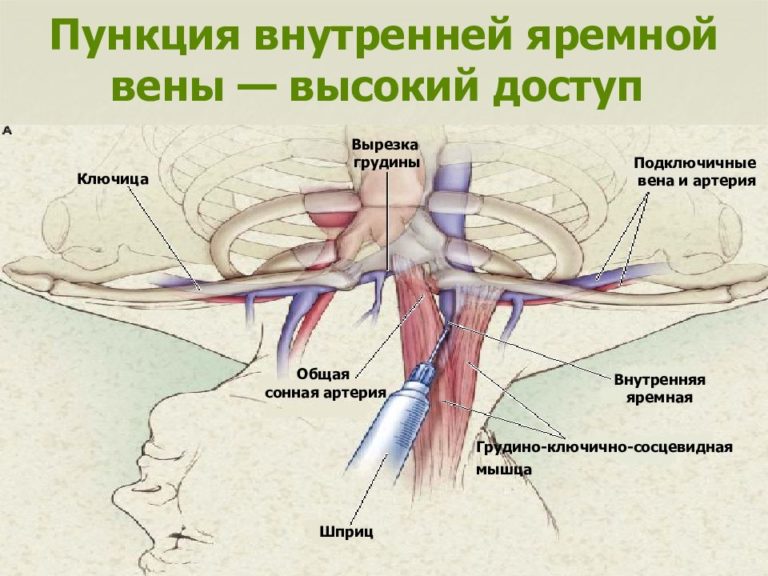 Где находится периферическая вена у человека фото