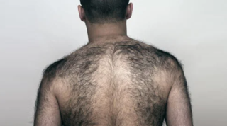 Волосы на спине мужчины врачи