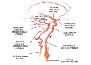 Поток крови по сонным артериям норма