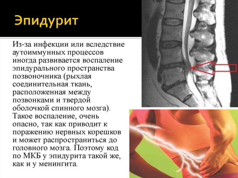 Параорбитальная гематома карта вызова смп