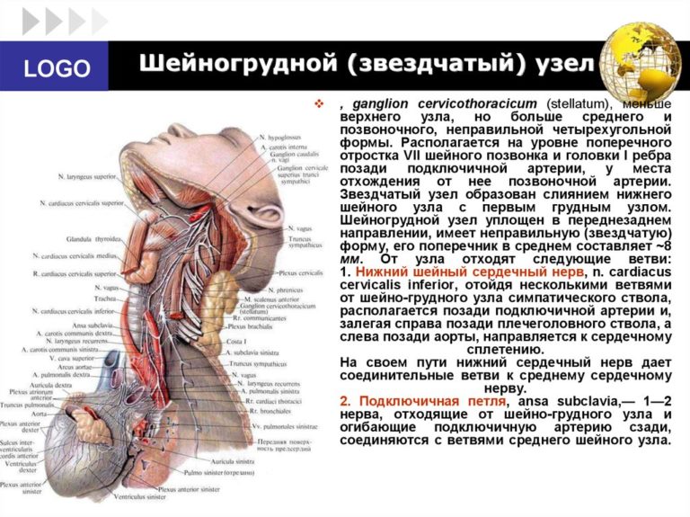 Цервикобрахиалгия слева на фоне шейного