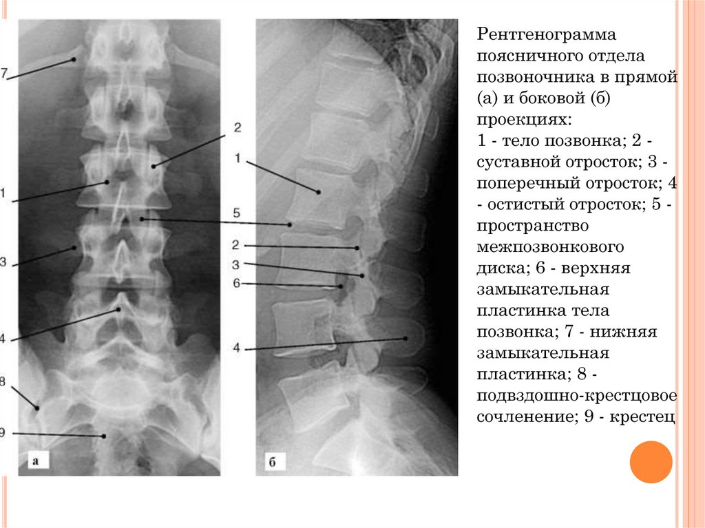 Как делают рентген пояснично крестцового отдела позвоночника фото