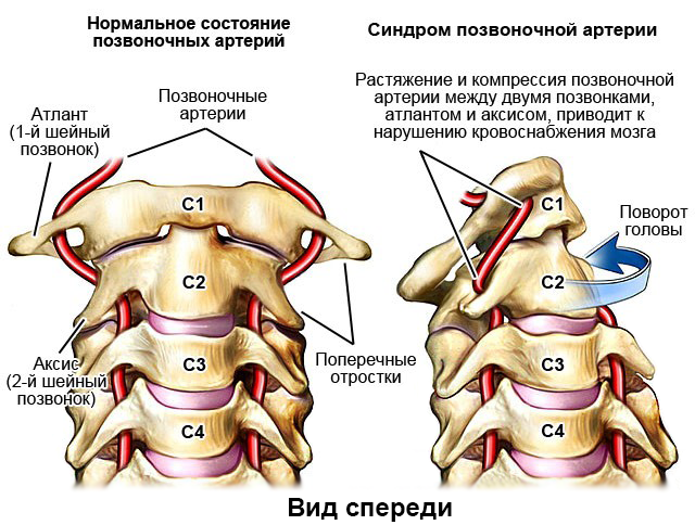 Аномалия киммерли фото