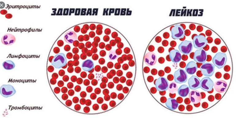 Увеличение подмышечных лимфоузлов фото