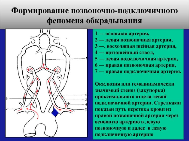 Сегменты подключичной артерии схема