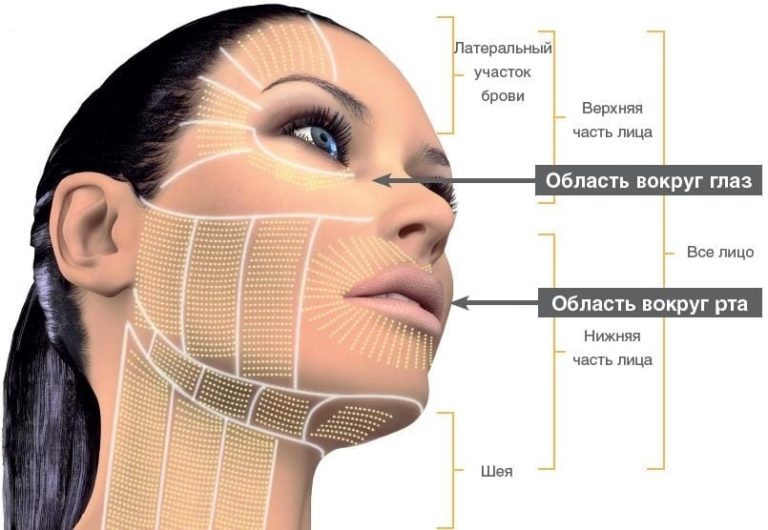 Сколько линий смас лифтинг нужно на лицо и шею схема