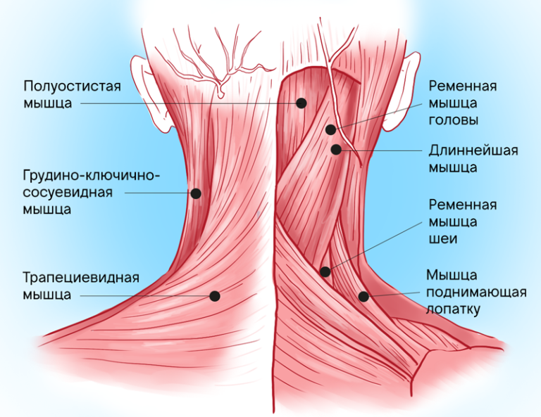 Упражнения для укрепления мышц шеи: растяжка, гимнастика, ЛФК .