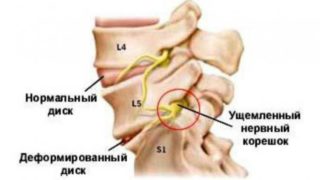 Болит горло и за ушами шея без температуры